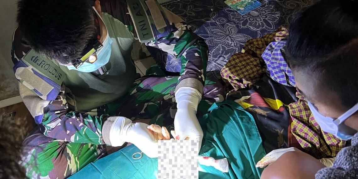 Alat Vital Tidak Normal, Dokter Satgas Yonif 527 Baladibya Yudha Lakukan Khitan Darurat